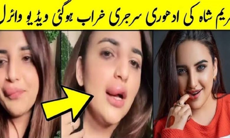 Pakistani Tiktok Star Hareem Sha Lip Job: Why Hareem Shah Left Midway During Lip Filler Procedure